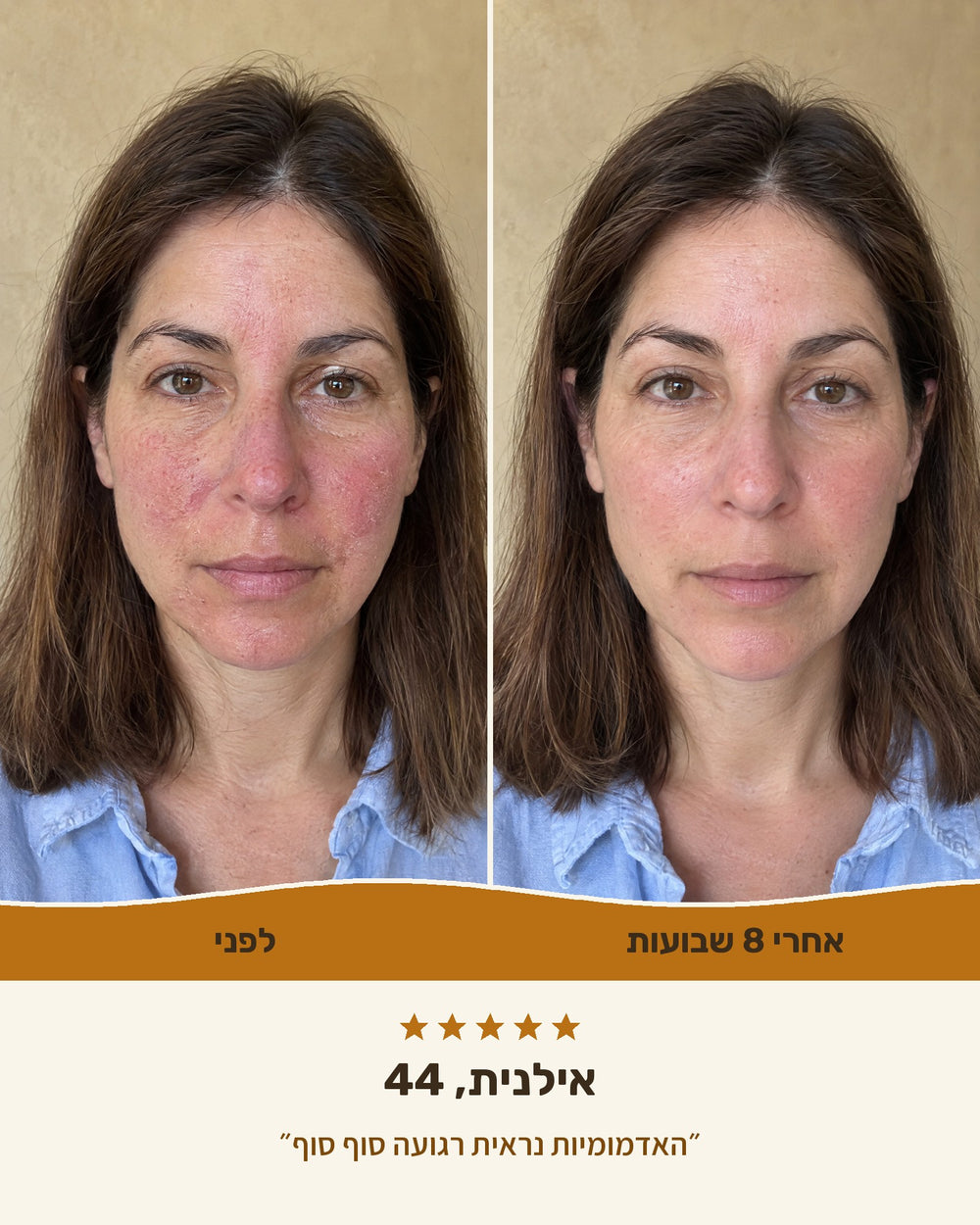 אילנית, 44 — לפני ואחרי 8 שבועות עם קרם טאלו ודבש