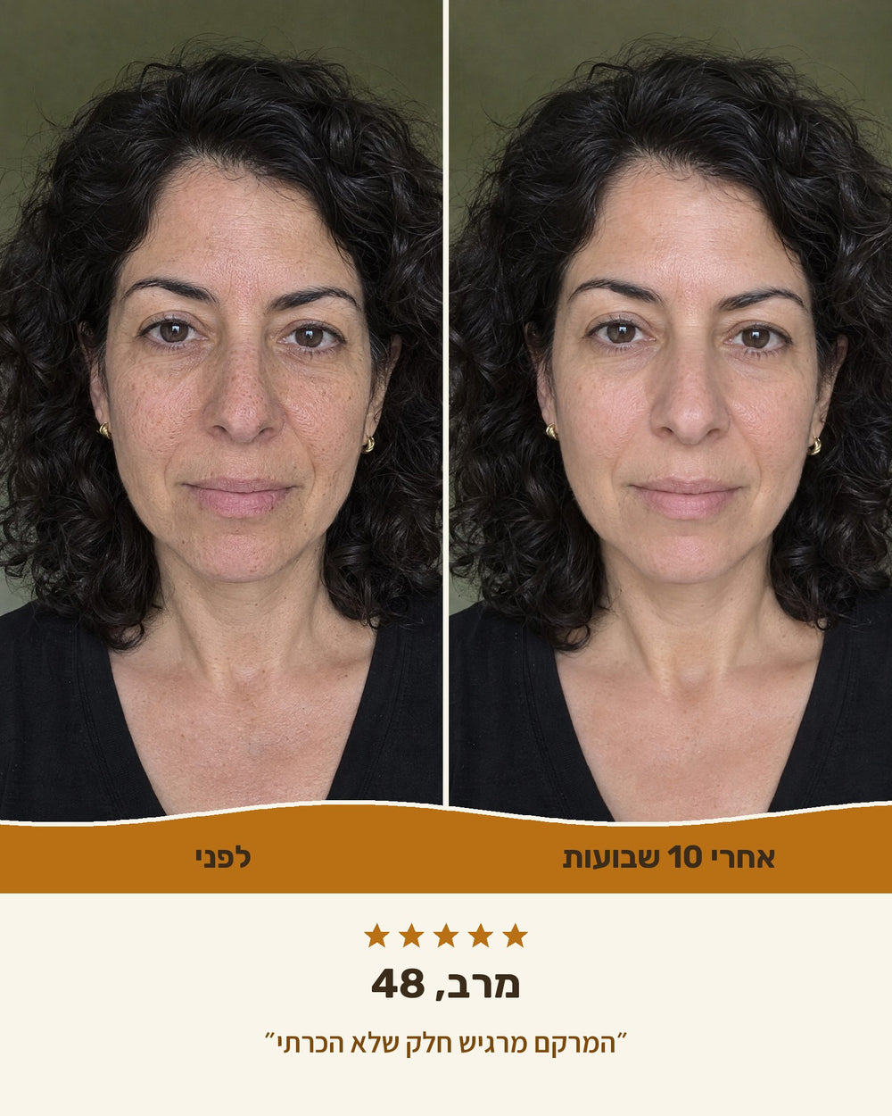מרב, 48 — לפני ואחרי 10 שבועות עם קרם טאלו ודבש