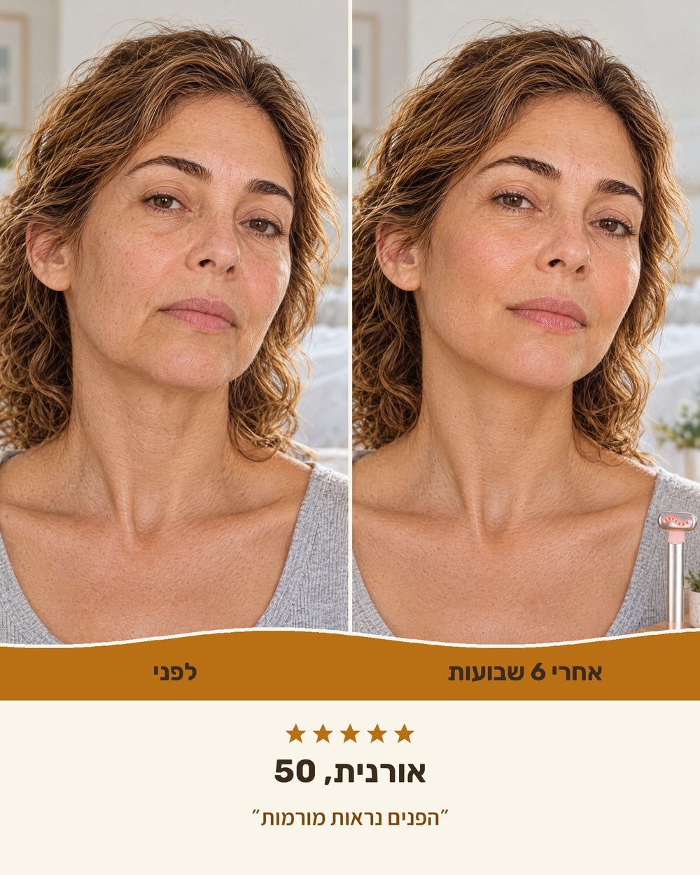 אורנית, 50 — לפני ואחרי 6 שבועות עם גלואו-ליפט™
