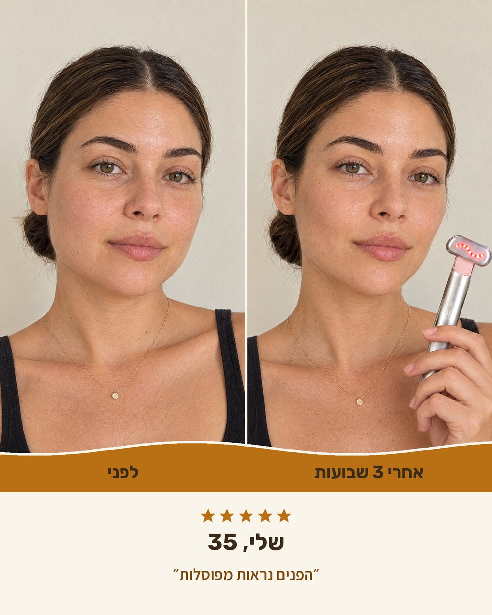 שלי, 35 — לפני ואחרי 3 שבועות עם גלואו-ליפט™