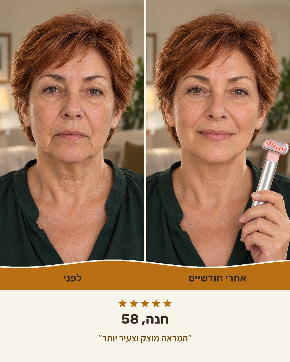 חנה, 58 — לפני ואחרי חודשיים עם גלואו-ליפט™