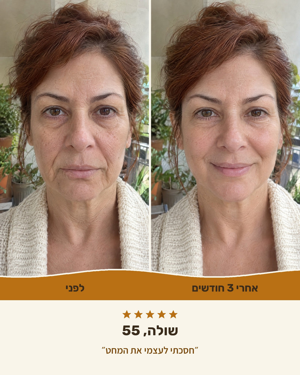 שולה, 55 — לפני ואחרי 3 חודשים עם קרם הליפט
