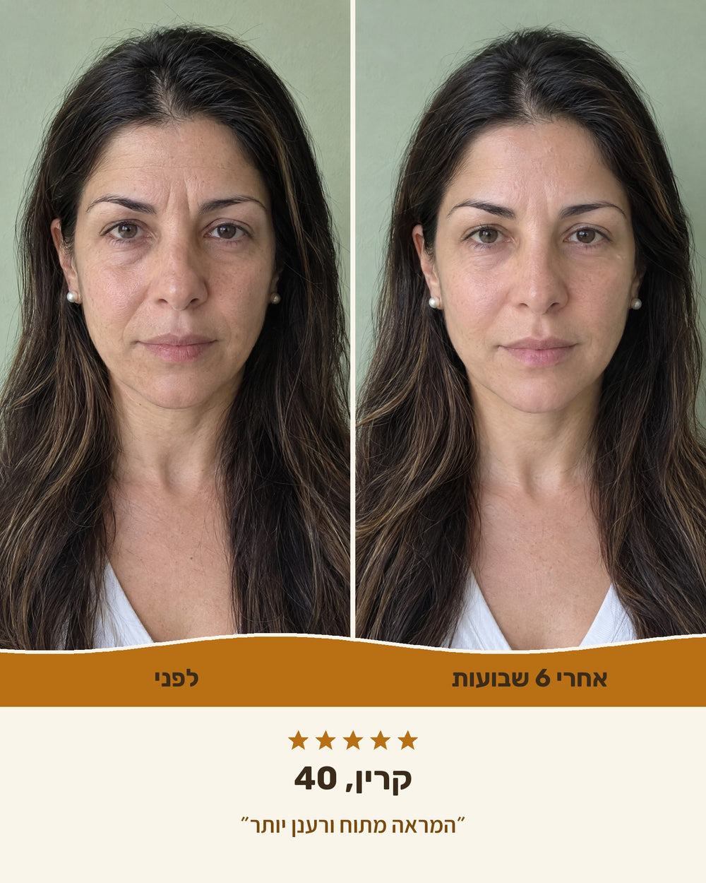 קרין, 40 — לפני ואחרי 6 שבועות עם קרם הליפט