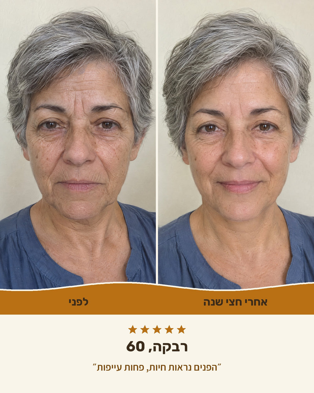 רבקה, 60 — לפני ואחרי חצי שנה עם קרם הליפט