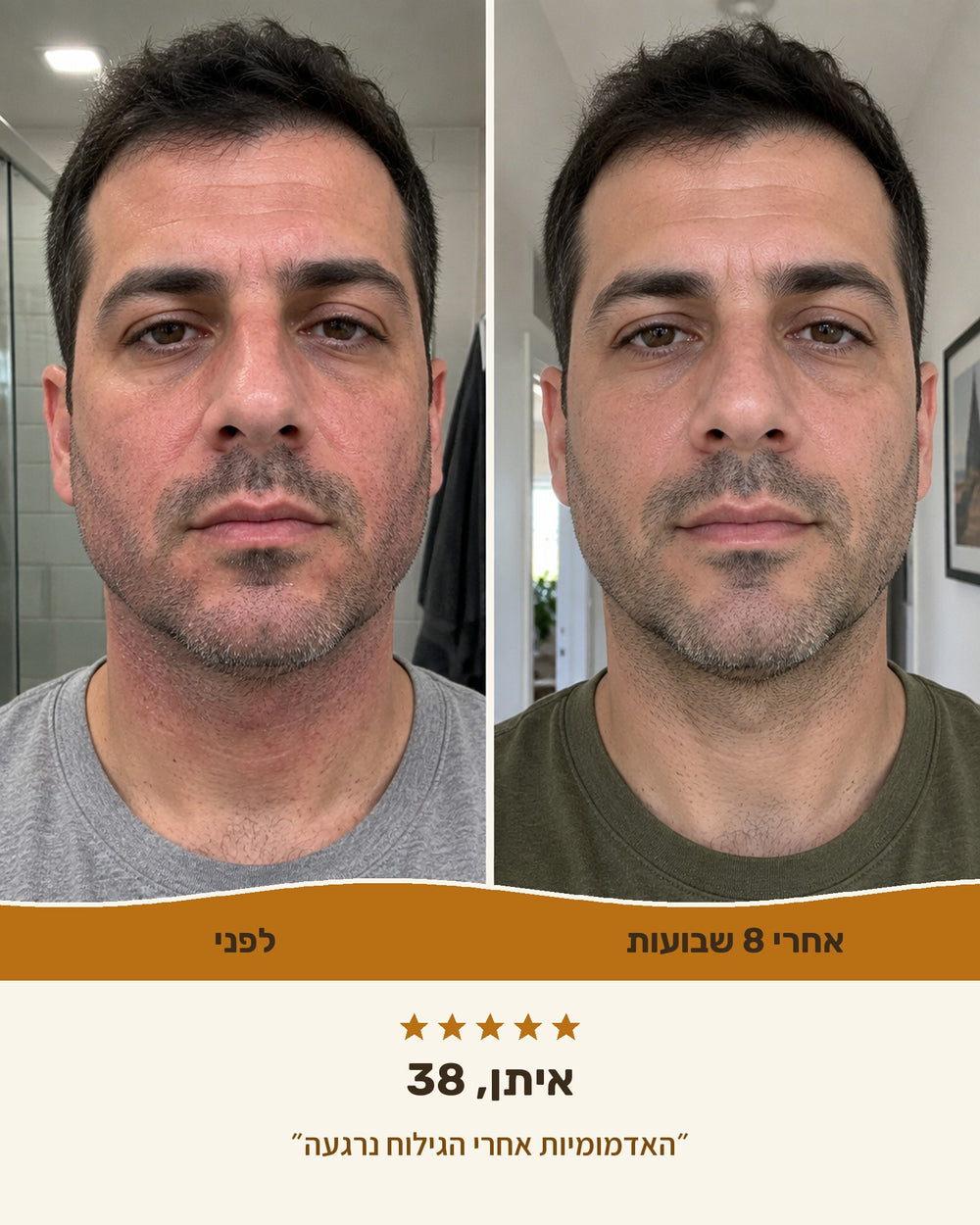איתן, 38 — לפני ואחרי 8 שבועות עם קרם טאלו לגברים