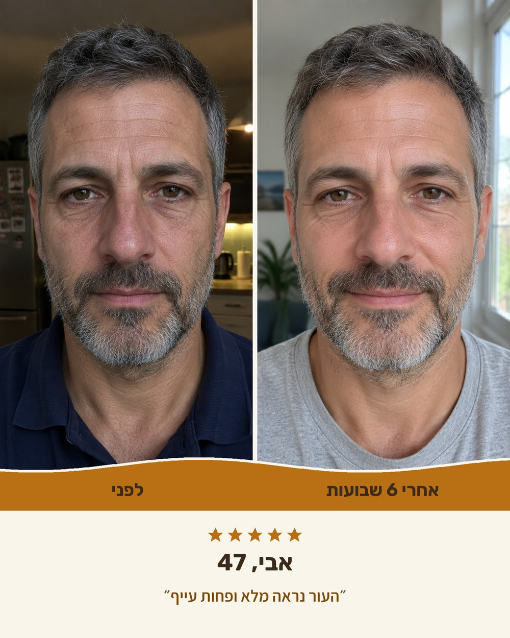 אבי, 47 — לפני ואחרי 6 שבועות עם קרם טאלו לגברים