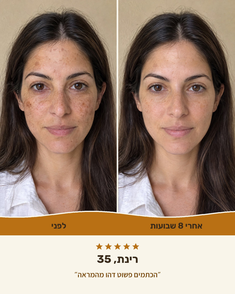רינת, 35 — לפני ואחרי 8 שבועות עם סבון הכורכום