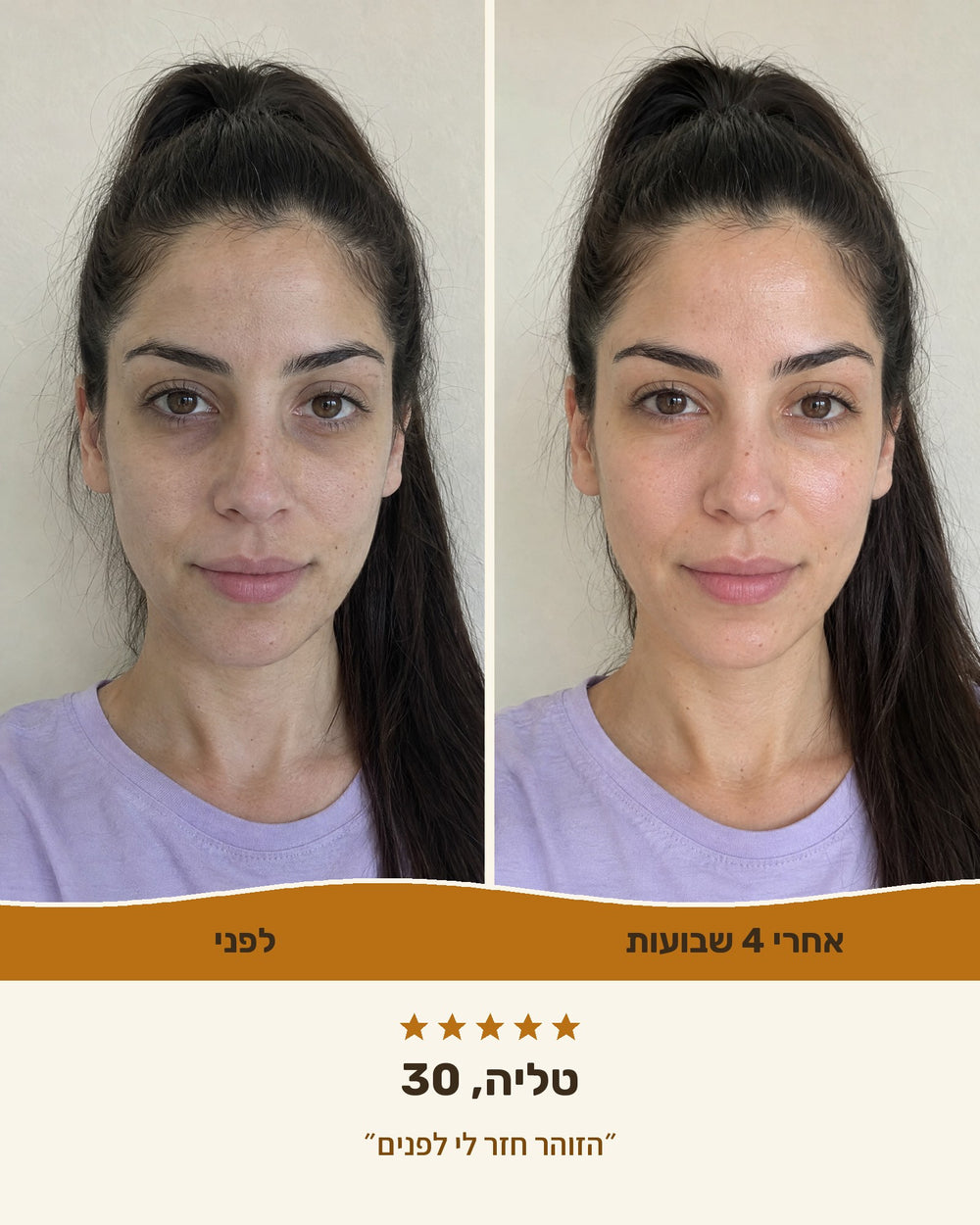טליה, 30 — לפני ואחרי 4 שבועות עם קרם ויטמין C