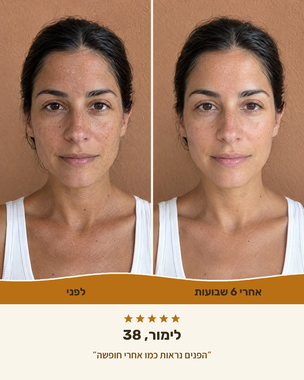לימור, 38 — לפני ואחרי 6 שבועות עם קרם ויטמין C