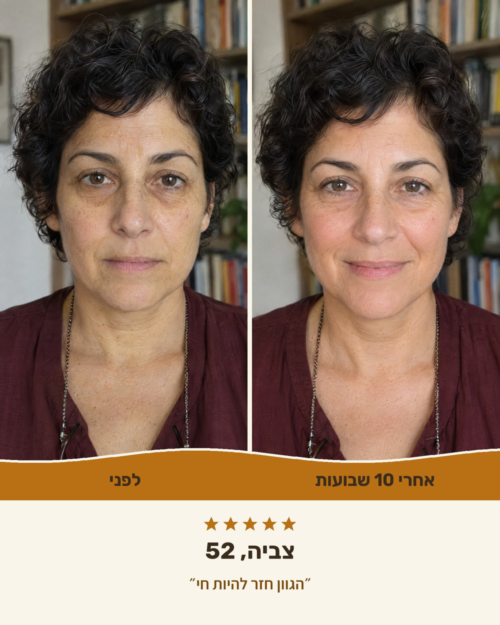 צביה, 52 — לפני ואחרי 10 שבועות עם קרם ויטמין C