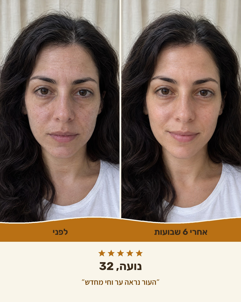 נועה, 32 — לפני ואחרי 6 שבועות עם קרם טאלו ודבש
