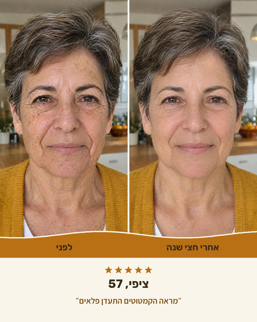 ציפי, 57 — לפני ואחרי חצי שנה עם קרם טאלו ודבש