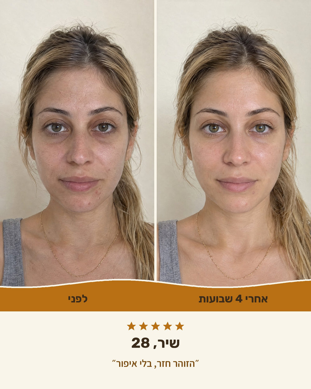 שיר, 28 — לפני ואחרי 4 שבועות עם קרם טאלו ודבש
