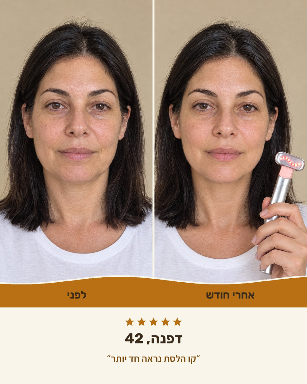דפנה, 42 — לפני ואחרי חודש עם גלואו-ליפט™