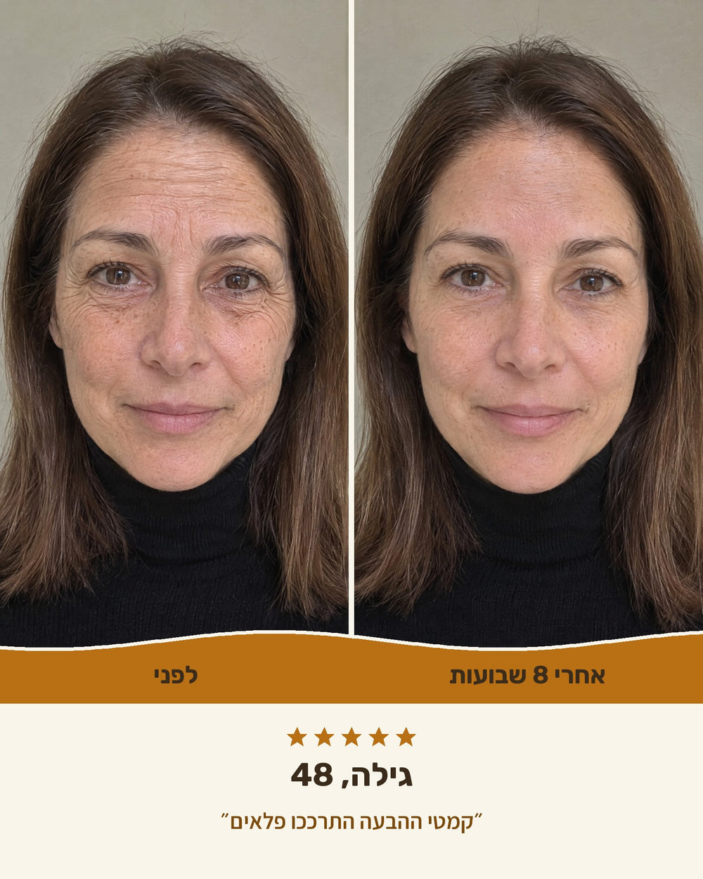 גילה, 48 — לפני ואחרי 8 שבועות עם קרם הליפט