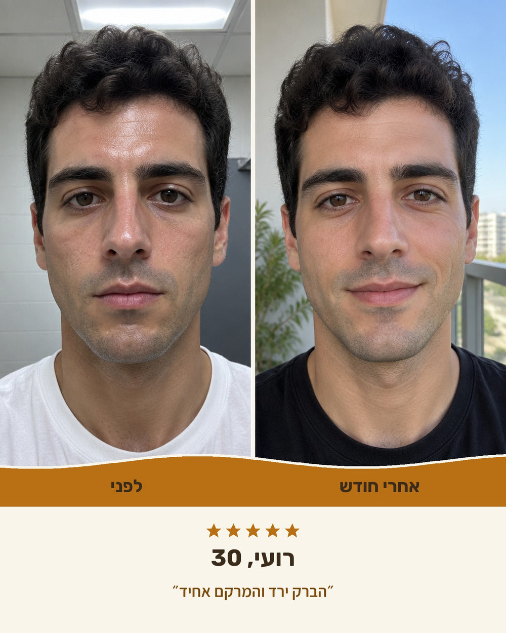 רועי, 30 — לפני ואחרי חודש עם קרם טאלו לגברים