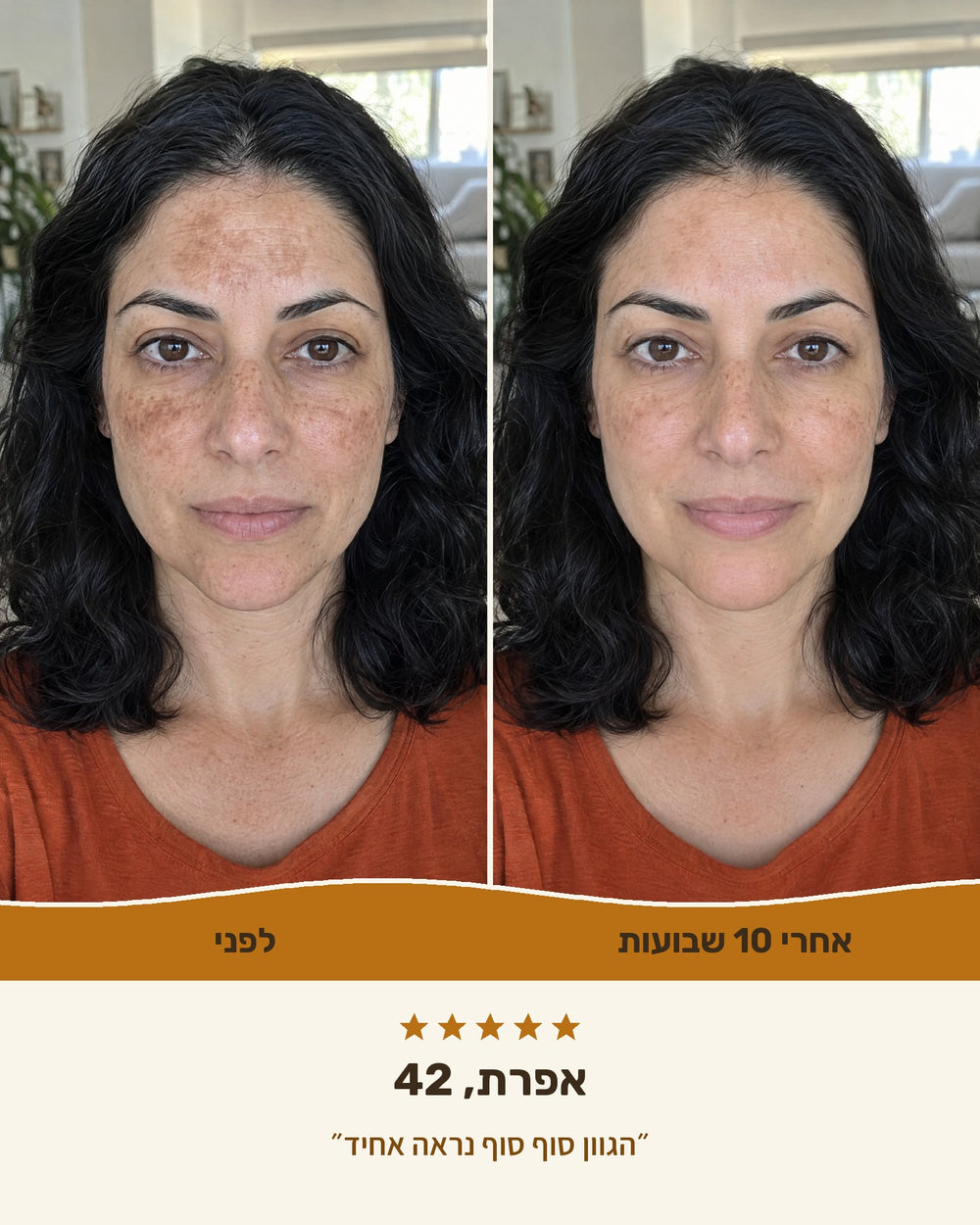 אפרת, 42 — לפני ואחרי 10 שבועות עם סבון הכורכום