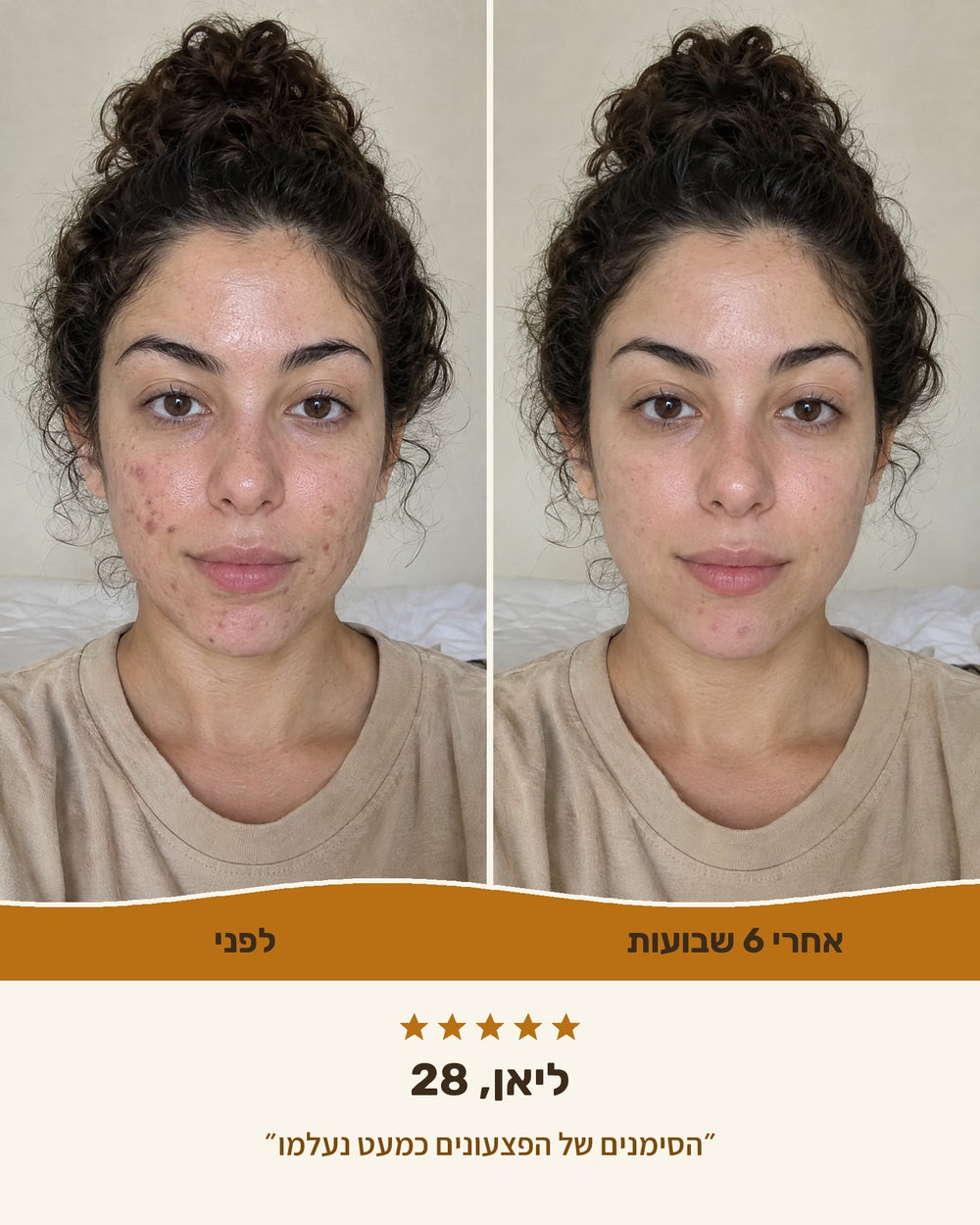 ליאן, 28 — לפני ואחרי 6 שבועות עם סבון הכורכום