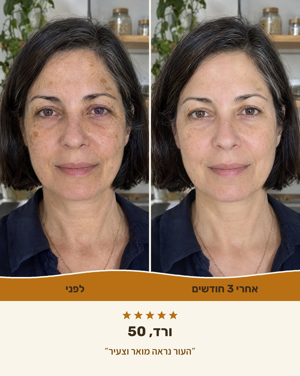 ורד, 50 — לפני ואחרי 3 חודשים עם סבון הכורכום